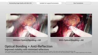 surgical-monitor-27hs714s-2025-feature-00-fullmovie
