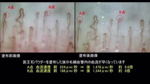 楽天市場】海底火山由来の天然鉱石「医王石」100％【医王山の