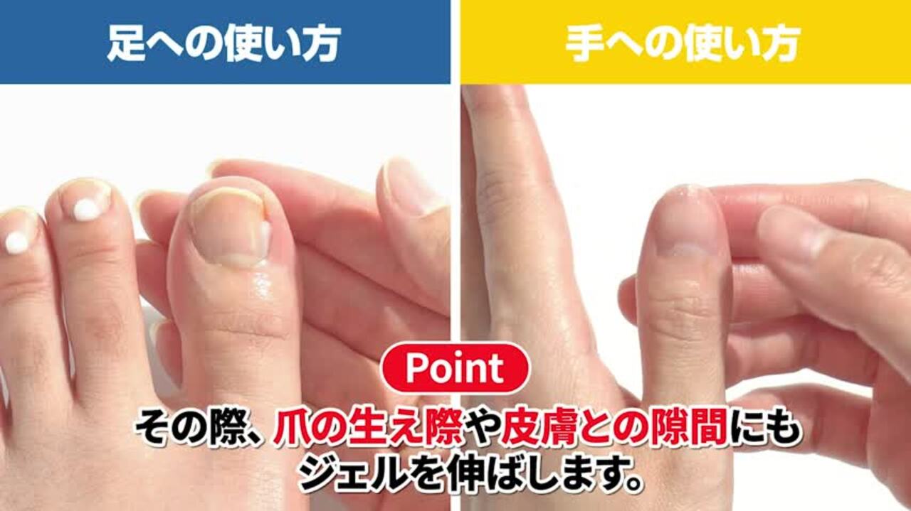 ⭐︎薬用爪ジェル3箱セット⭐︎爪トラブルの方も必見！ Amazon.co.jp: 【3本セット】[指定医薬部外品] 爪 際まで浸透