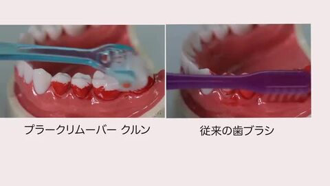 楽天市場】歯ブラシ 〈 ブルー ／ ピンク 〉 超極細毛 360度