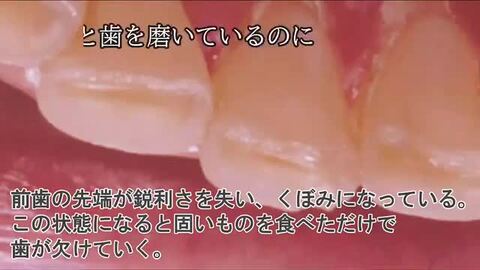 【即日発送】知る・診る・対応する 酸蝕症 知る・診る・対応する 酸蝕症の購入ならWHITE CROSS