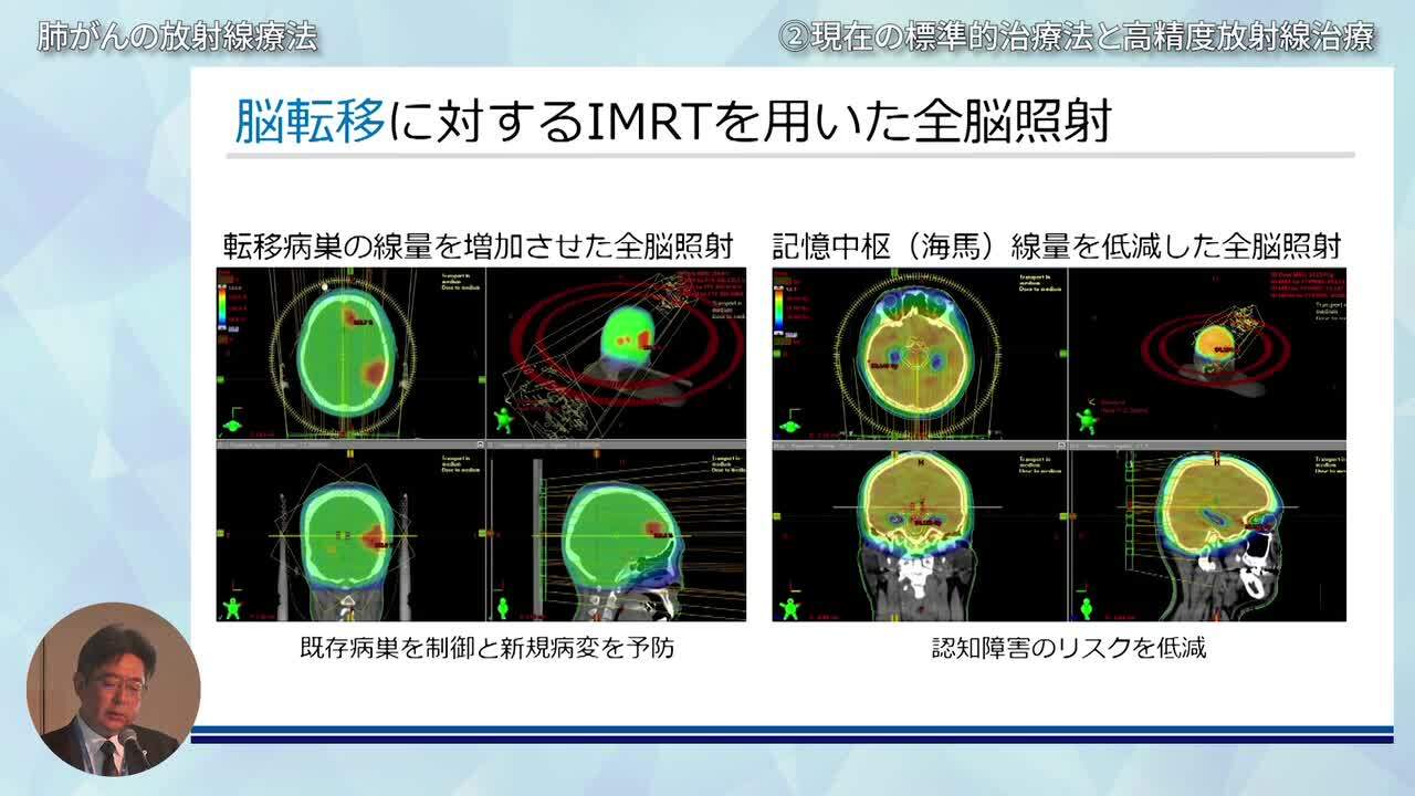 最新臨床肺癌学2022年12月号