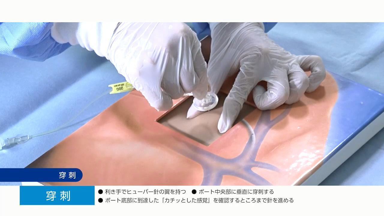 医療用ビデオ Amazon.co.jp: 医療用腹腔鏡トレーナーボックス、腹腔鏡内視鏡トレーナー、学生トレーニングおよび設置ビデオ用の腹腔鏡シミュレータートレーナー、4つの手術器具および6つのトレーニングモジュール付き,30º  : 産業・研究開発用品