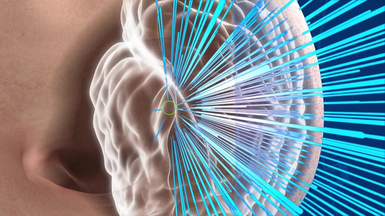 宇宙エネルギー療法 現代医学の限界を超えて 潮汐破壊現象の最高精度の偏光観測―超大質量ブラックホールの