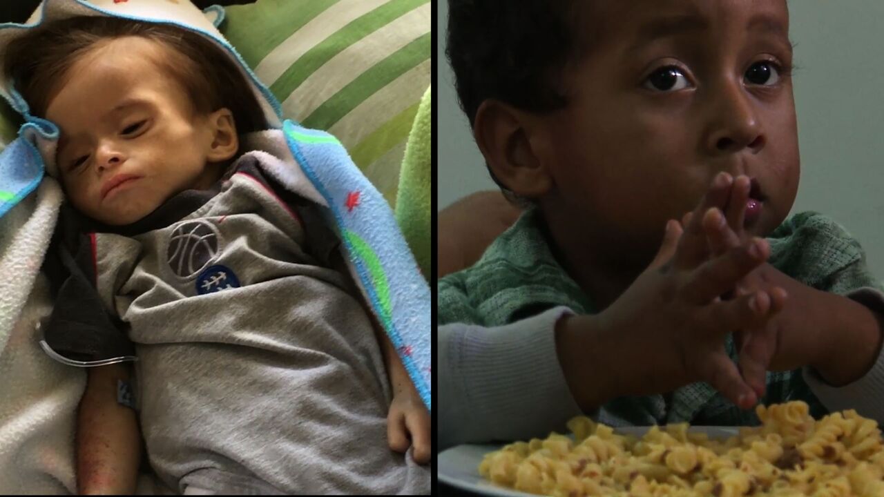 動画 生後15か月でも新生児と同じ体重 ベネズエラ危機で子どもたちが栄養失調に 写真1枚 国際ニュース Afpbb News