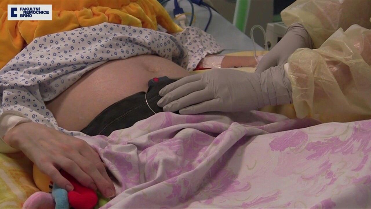 動画 脳死した母親 最も成熟度の高い 水準の女児出産 出産前後の映像 チェコ 写真1枚 国際ニュース Afpbb News